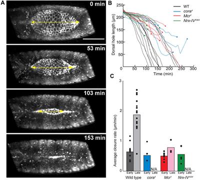 Septate junction proteins are required for cell shape changes, actomyosin reorganization and cell adhesion during dorsal closure in Drosophila